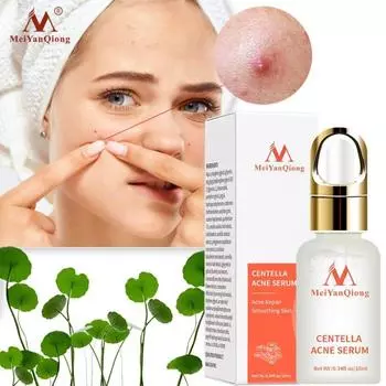 MeiYanQiong Centella Asiatica, эссенция для удаления прыщей, сыворотка для лица, жидкая увлажняющая жидкость против морщин, сужение пор, масло для контроля отбеливания кожи