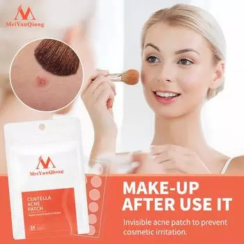 MeiYanQiong Centella патчи от прыщей, наклейки для лечения прыщей, инструмент для удаления пятен, маска для лица, уход за кожей, водонепроницаемые 24 пластыря 1bag