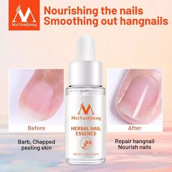 MeiYanQiong Nail Repair Nail Feet Care Essence Nail Foot Отбеливающий гель для удаления ногтей на пальцах ног 1pcs