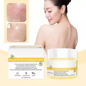 Многофункциональное успокаивающее увлажняющее средство от экземы снимает зуд при экземе и улучшает текстуру кожи благодаря мягким ингредиентам One Size