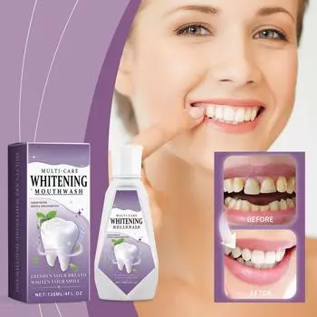 Многофункциональный отбеливающий ополаскиватель для полости рта, отбеливающий ополаскиватель для полости рта, ополаскиватель для полости рта, он может глубоко очистить стойкий налет на поверхности зубов(120мл) One Size