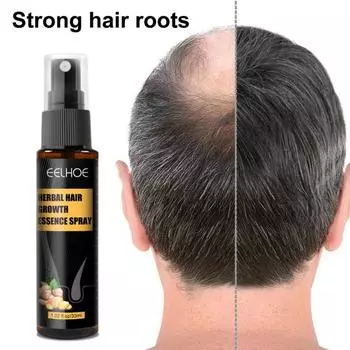 Многофункциональный увлажняющий безопасный травяной спрей-эссенция для роста волос