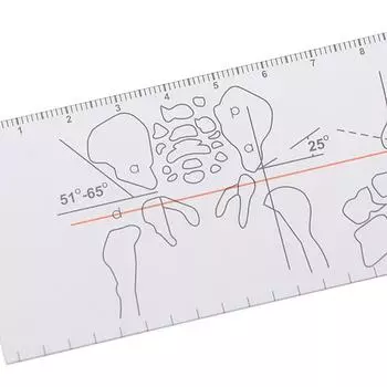 Многолинейный гониометр, угловая медицинская линейка, инструменты для ортопедии суставов