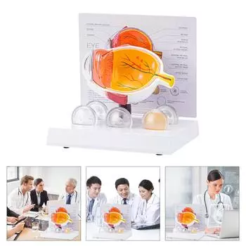 Модель анатомии человеческого глаза Анатомическая патологическая модель глазного яблока Обучающее пособие Реалистичная патологическая модель анатомии глазного яблока
