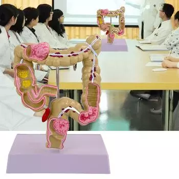 Модель толстой кишки человека для обучения анатомии Медицинская учебная модель Патологии толстой кишки Модель для изучения и демонстрации