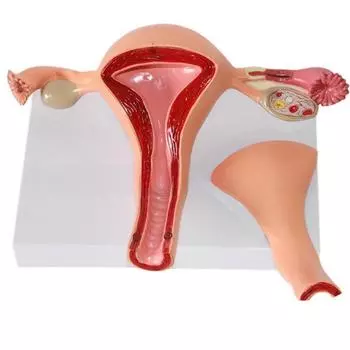 Модель женской репродуктивной системы для обучения с патологическими примерами