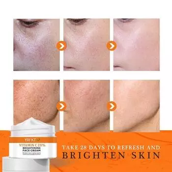 Мощный отбеливающий крем для кожи. Удаляет веснушки и темные пятна. Отбеливающий крем VC. 5G