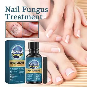 N Ail Treatment N Ail Treatment Nail Treatment Toenail Care, Быстродействующая жидкость для ухода за ногтями для всего восстанавливает здоровый вид ногтей 30 мл