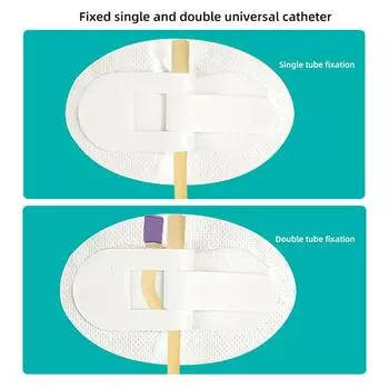 Надлобковый дренажный катетер Катетер для отвода мочи на ногу Двойная трубка Фиксированный ленточный катетер Мочевой катетер Держатели для повязок на ногу Трубка-держатель катетера