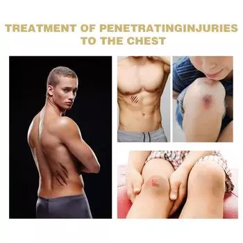 Нагрудное уплотнение South Moon с вентиляцией, компактное, водонепроницаемое, дышащее, 6 шт./кор. белый