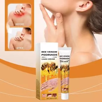 Наружное применение для лечения опоясывающего лишая рук и ног и облегчения зуда