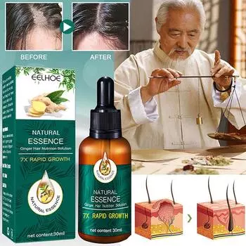 Натуральная эссенция для роста волос с имбирем, быстрый рост волос, против выпадения волос, восстановление сломанных волос, укрепление корней волос, питание поврежденных волос 30 ml