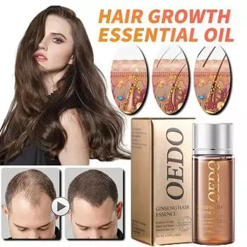 Натуральное масло для роста волос – стимулирует рост волос и предотвращает их выпадение 20ml