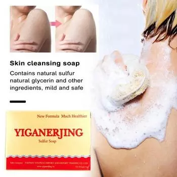 Натуральное мягкое эффективное безопасное нераздражающее очищающее средство для кожи для контроля жирности пор и очищения