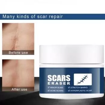 Не раздражающий восстанавливающий синтетический крем для удаления шрамов 5g