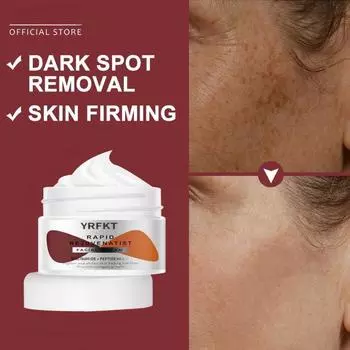 Ниацинамид, отбеливающий крем, уход за кожей с веснушками, эмульгаторы, пептид, антивозрастной крем для лица, морщин, темные пятна, меланодермия, удаление меланина 5G