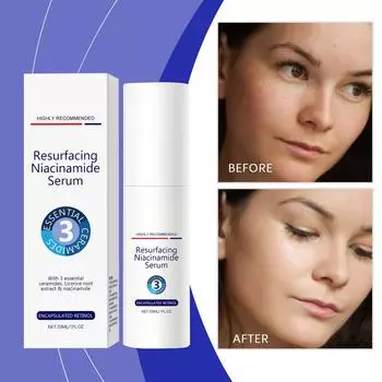 Niacinamide SerumLotion 30 мл Ниацинамидная мультиэмульсия Увлажняющая, смягчающая, разглаживающая и омолаживающая кожу One Size