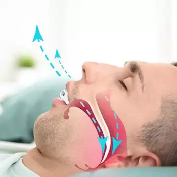 Ночная зубная капа, защита от шлифования, ночная защита, защита от шлифовки зубов