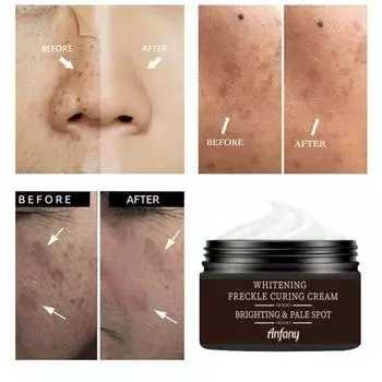 Новейший отбеливающий крем для лица, ремонт, выцветание веснушек, удаление темных пятен, средство для удаления меланина, осветляющий крем для лица от веснушек 5g