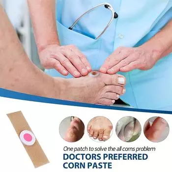 Новые 6/12/30 шт. для удаления мозолей на ногах, подошвенных мозолей 6Pcs