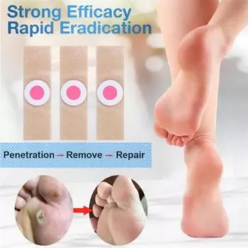 Новые 6/12/30 шт. для удаления мозолей на ногах, подошвенных мозолей 6Pcs