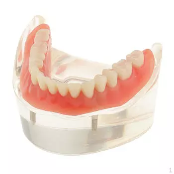 Обучение изучению зубов полости рта. Демонстрационная модель съемного протеза. Нижний 2-й имплантат. Демонстрационное обучение -