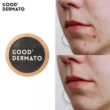 Очищающее мыло Good Dermato Acne Care 115 г (натуральное мыло ручной работы глубоко очищает 99,9% кожного сала в порах до корней), 1 кусок
