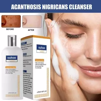 Очищающее средство Black Acanthopanax, глубокое очищение, смягчение кожи, восстановление, устранение тусклости лица и отбеливание кожи 50ml