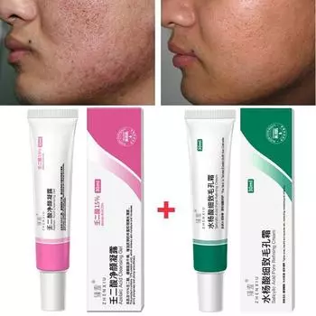 Очищающий гель с 15% салициловой кислотой и крем для сужения пор, сужение пор, улучшение прыщей, удаление угрей, антивозрастной набор для контроля жирности Salicylic acid