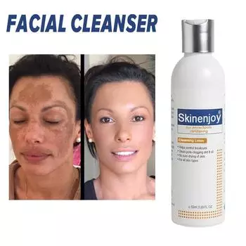 Очищающий лосьон Acanthosis Nigricans, эффективный, глубокое увлажнение для чувствительной ежедневной чистки F4U7 white-50ml