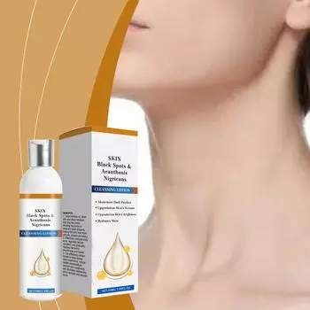 Очищающий лосьон от прыщей, прыщей и акантоза Nigricans, пятен и акантоза Nigricans, Очищающий лосьон Acanthosis Nigricans, средство для удаления темных пятен, 50 мл One Size