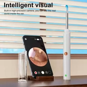 Очиститель ушей с камерой для удаления ушной серы, беспроводной интеллектуальный визуальный инструмент для удаления ушной серы с 6 светодиодами B чёрный