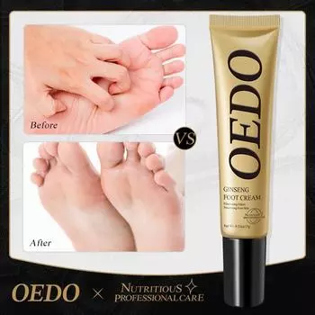OEDO Женьшеневый крем для ногтей Удаление ногтей на ногах Анти-крем для ухода за ногами Отбеливание ног 1pcs
