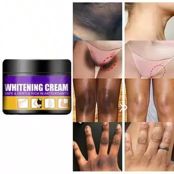 Осветление кожи, отбеливание, осветление цвета лица, подмышки, колени, увлажняющий крем для локтей, увлажняющий и осветляющий консилер для черной кожи. 5G