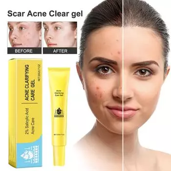 Осветляющий гель для ухода за акне Гель от прыщей Салициловый гель для исчезновения следов прыщей и прыщей, улучшения текстуры кожи и ухода за гладкостью вашей кожи 20 г One Size жёлтый