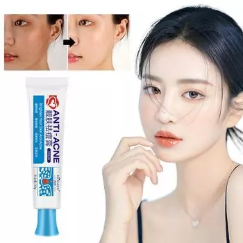 Осветляющий крем для удаления угрей Осветляющий гель для удаления угрей Нежный безопасный гель Осветляющий акне-r W3Z6 blue-25g