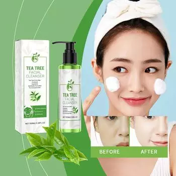 Освежающее очищающее средство для контроля жирности кожи, нежное очищающее молочко унисекс, 100 мл One size белый