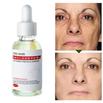 Отбеливающая эссенция против веснушек, увлажняющая, сужающая поры, осветляющая тон кожи и контролирующая жирность сыворотки для лица 30ml