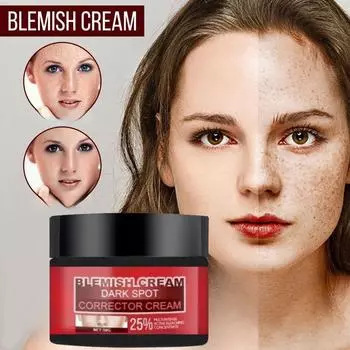Отбеливающий и осветляющий крем от прыщей, очищающий, осветляющий и уменьшающий пятна, универсальный для мужчин и женщин. 5G