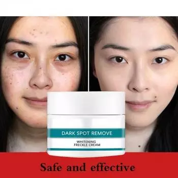 Отбеливающий крем, исчезающие пятна, черные точки, меланин, увлажняющий, осветляющий, мягкий, гладкий, укрепляющий, уход за кожей 5G