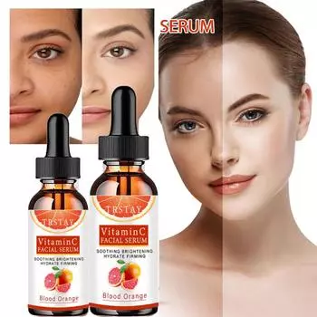 Отбеливающий крем от веснушек, эффективный крем для удаления мелазмы, темных пятен, крем для выцветания, увлажнения, осветления, гладкости, красоты, ухода за кожей лица 5ml