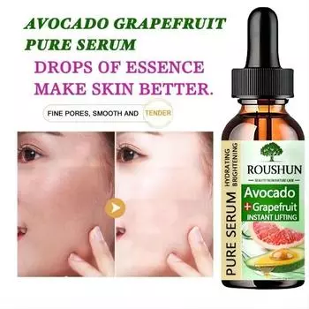 Отбеливающий крем от веснушек, эффективный крем для удаления мелазмы, темных пятен, крем для выцветания, увлажнения, осветления, гладкости, красоты, ухода за кожей лица 5ml