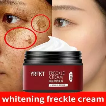 Отбеливающий крем от веснушек, удаление мелазмы, пигмент прыщей, меланин, темные пятна, крем для удаления пигментации веснушек 5G