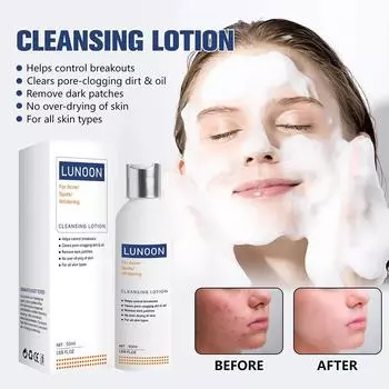 Отбеливающий очиститель для лица, удаляющий веснушки, осветляющий темные пятна от прыщей, очищающий кожу Mo J6Y9 white-50ml