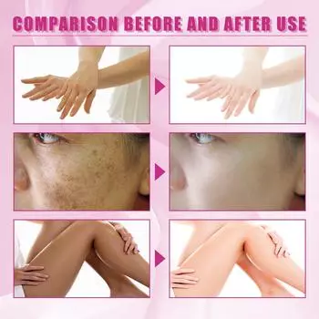 OUHOE 30 мл Экстрасильное пилинговое масло отбеливающее питательное масло для кожи средство от растяжек и темных пятен жёлтый