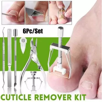 Паронихия Скоба для ногтей Удаляющая омертвевшую кожу Кусачки для ногтей Набор для вросших ногтей Вросший ноготь серебряный