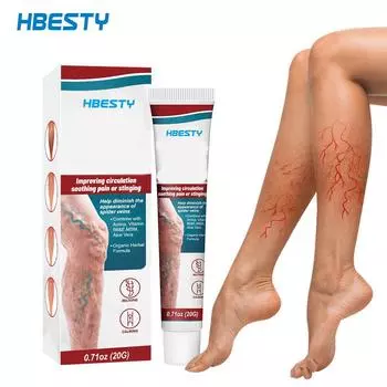 Паста и паук облегчают состояние ног, улучшают кровообращение