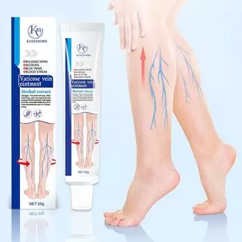 Паста от варикозного расширения вен улучшает кровообращение