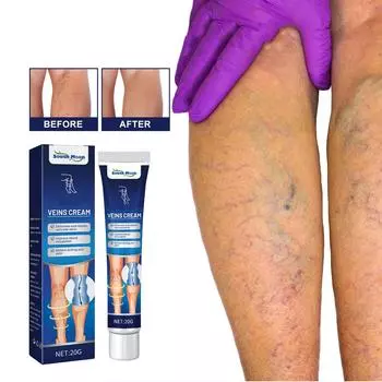 Паста Venoheal Vein Ease, паста для вен и сосудистых звездочек облегчает состояние ног, улучшает кровообращение 1 Pcs