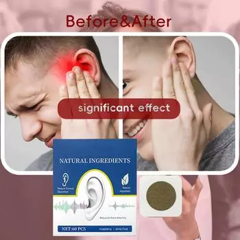 Patch Effectively Reduces Tinnitus And Improves Ear Discomfort. Tinnitus Patch Set Of 60 Pcs One Size красный